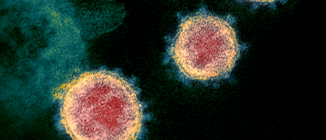 Novel Coronavirus SARS, NIH