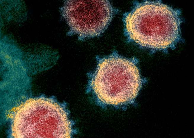 Novel Coronavirus SARS, NIH